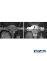 PLAQUE PROTECTON RIVAL DIFFERENTIEL VW AMAROK 2016-2019