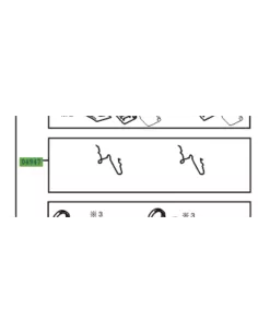 Clips / ressorts anti vibration des plaquettes dans l'étrier avant 2